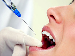 anesthesie dentaire dinan